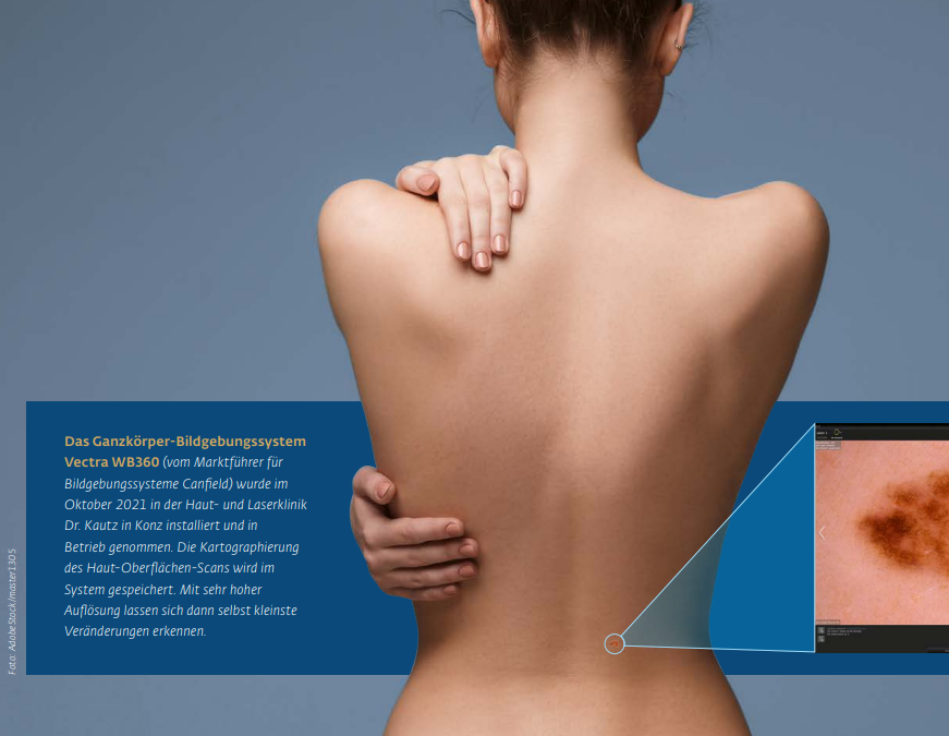 Rückenansicht zur Hautkrebsdiagnostik mit Vectra 360